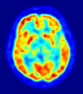 A new study by Israeli researchers demonstrate that the brain cannot be categorized as “male” or “female.” Photo: Wikimedia Commons