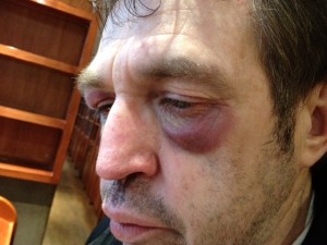 France anti-Semitic attack victim David.