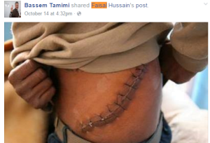 A Facebook post by a known Palestinian activist claiming the IDF was harvesting Palestinian victims' organs.