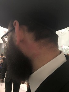 The Chassidic man showing off his bruises after he was beaten up by a "Arab looking man" who demanded the Jew get up from his seat in Manhattan's L'oreal Building. Photo: Facebook.