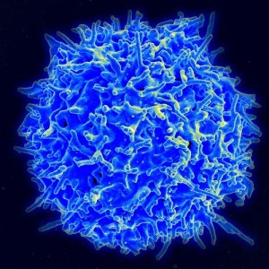 A healthy human T-cell. The research first pioneered by a Weizmann Institute Israeli scientist shows that T-cells can be modified genetically to destroy leukemia tumor cells. Photo: NIAID/NIH via Wikimedia Commons.