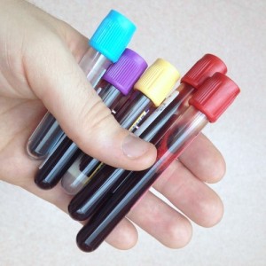 Containers with blood specimens. A new treatment at the Sheba Medical Center could help battle cerebral palsy. Photo: Tom Mallinson via Wikimedia Commons.