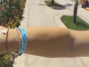 The blue wrist band distributed to Israelis at a Rhodes hotel. Photo: Orly and Guy researchers.
